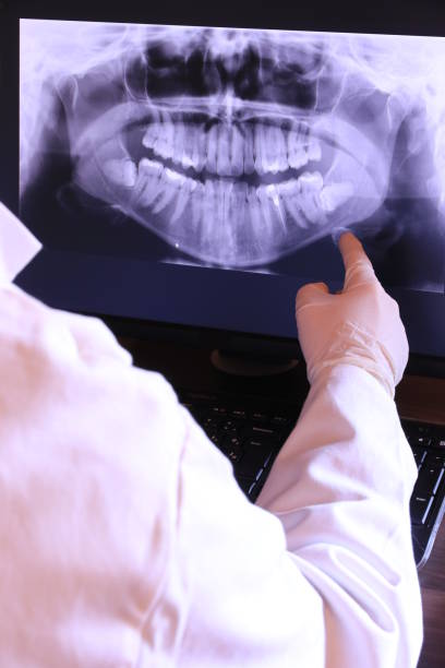 Best Knocked-Out Tooth (Avulsed Tooth) Treatment in Ragland, AL