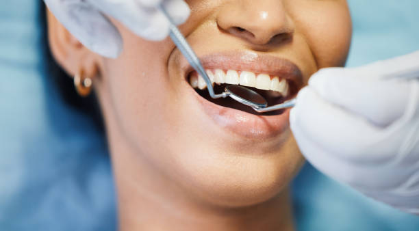 Best Emergency Treatment for Oral Infections in Ragland, AL